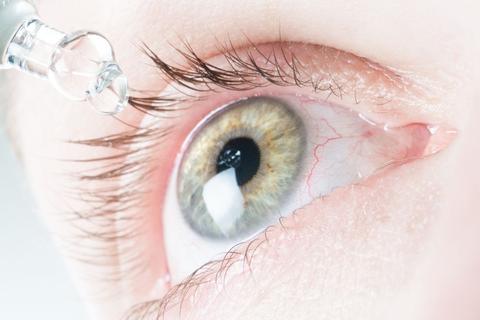 Das Auge ist von feinen Blutgefäßen durchzogen. Dass da mal eines platzt und für ein blutrotes Auge sorgt, lässt sich kaum vermeiden. © Franziska Gabbert/dpa-tmn
