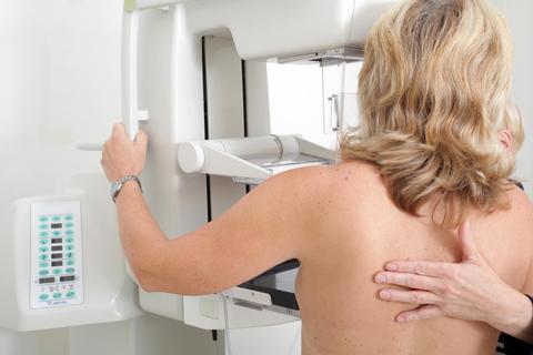 Eine Patientin bei der Brustkrebsvorsorge, der Mammografie. Tamoxifen wird Brustkrebspatientinnen bis zu zehn Jahre lang verschrieben, um das Wachstum hormonabhängiger Tumorzellen zu beeinflussen. Foto: Sven Bähren - stock.adobe.com